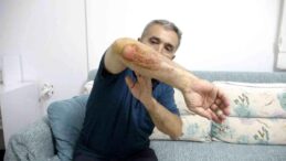 Otizmli oğluyla doğa gezisi sırasında sahipli köpeklerin saldırısına uğradı